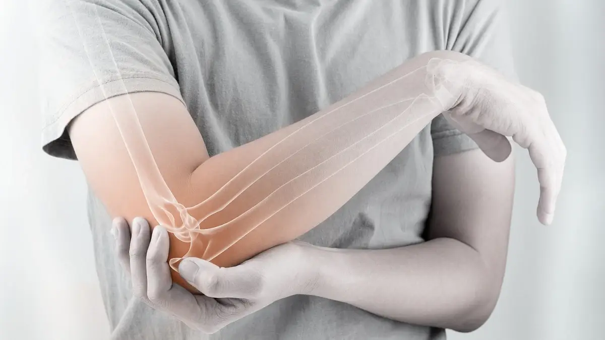 Reactive arthritis | Causes, symptoms, treatments
